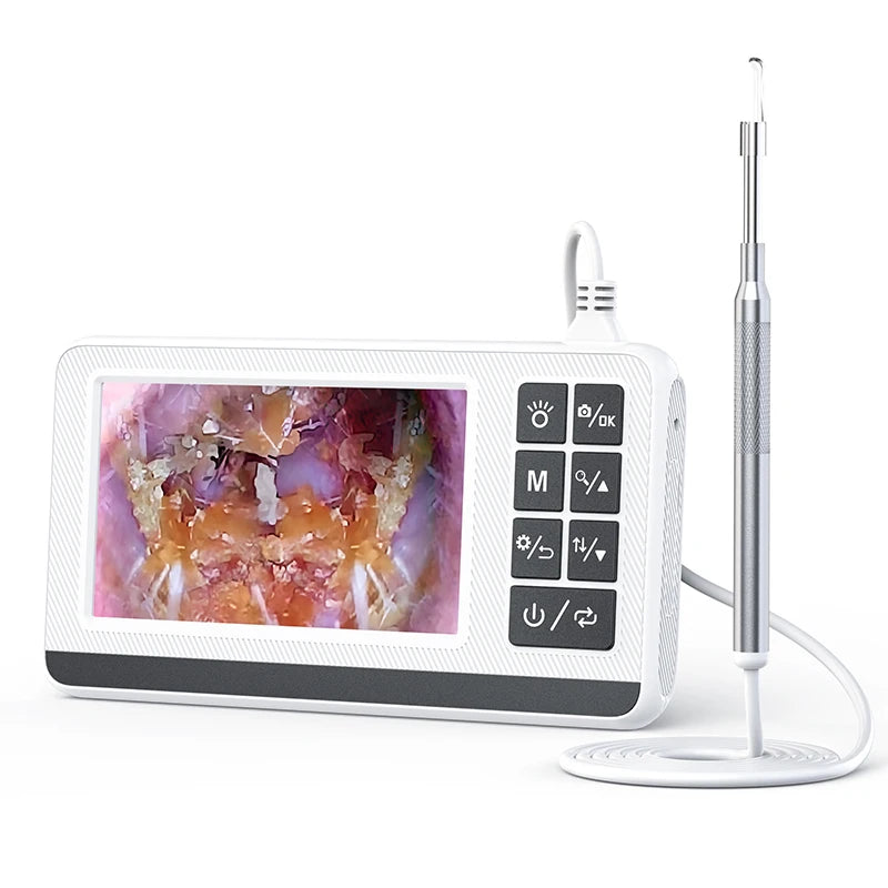 3.9mm4.3 Inch Digital Otoscope for Ear Wax Cleaning Smart Visual Ear Picking Stick Type-C Port Supports Connection to Computer